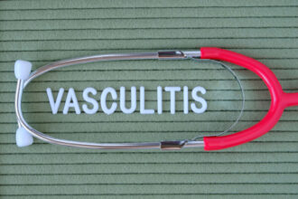 Vasculitis