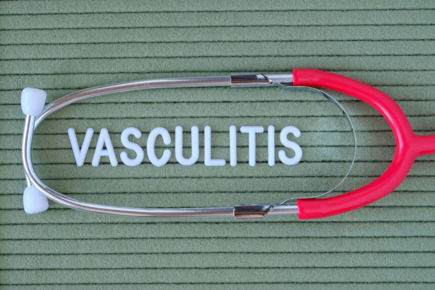 Vasculitis