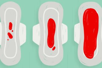 Spotting vs periods: Know the difference