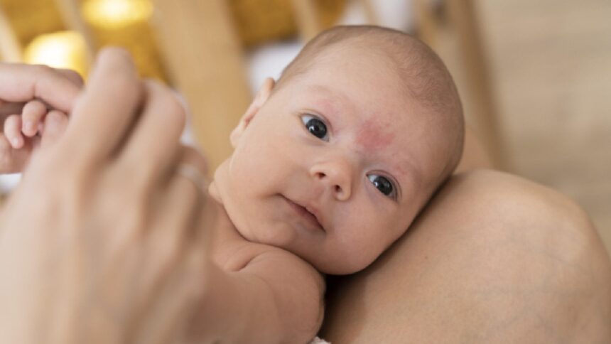 Baby skincare: 9 best tips for protecting baby’s skin