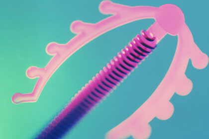 Getting an IUD Can Really F*cking Hurt (There, We Said It). So Why Isn’t This Pain Taken Seriously?