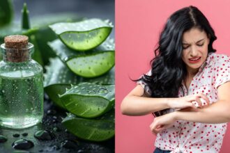 Aloe vera: 7 ways to use this home remedy to get rid of skin rashes