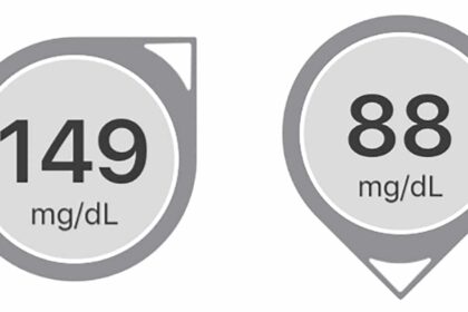 Two examples of Dexcom trend arrows