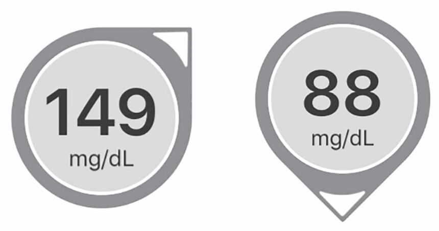 Two examples of Dexcom trend arrows