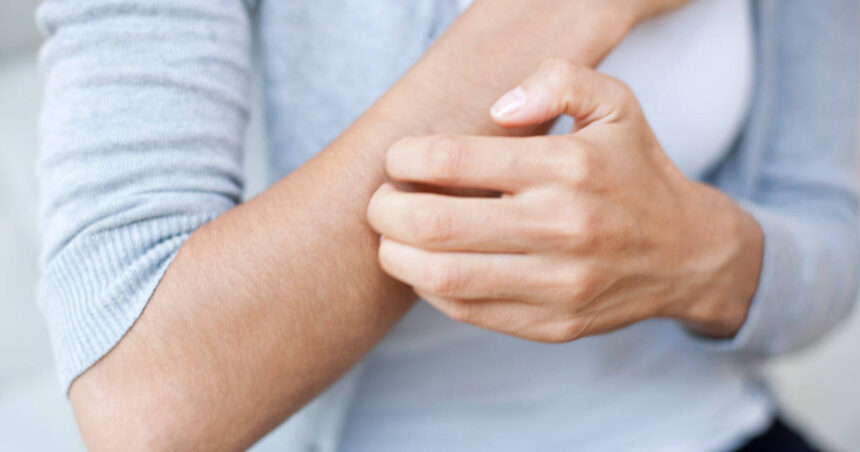 Diabetes and Itching - Causes and Treatment Options