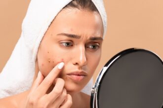 Say goodbye to cystic acne with these natural hacks!