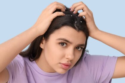 Zinc for dandruff: How to use it to deal with this scalp condition