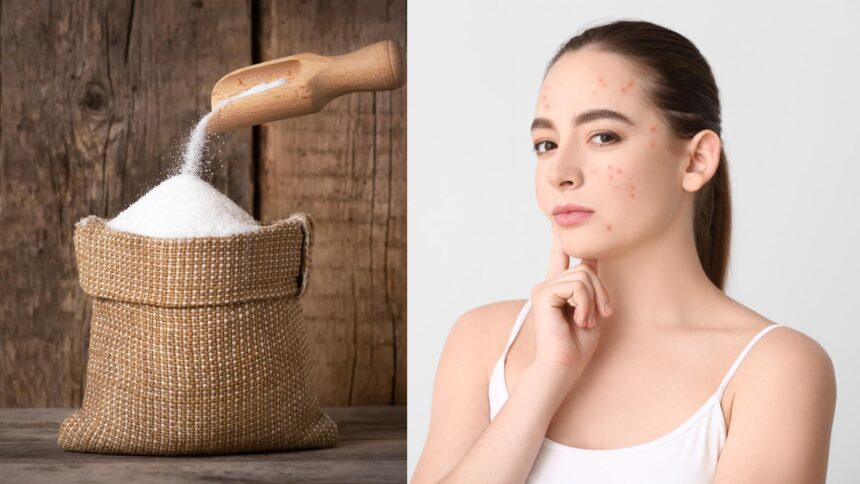 How does sugar affect your skin? 5 side effects of it